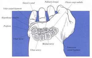 carpal tunnel in wrist