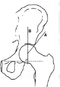 lateral center edge