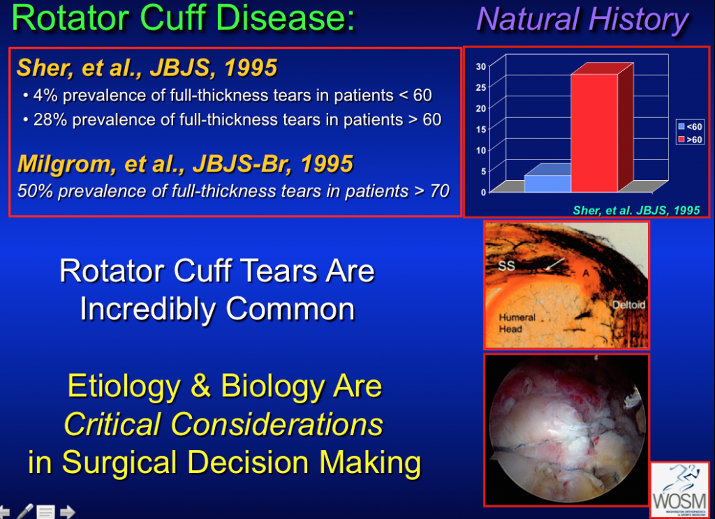 rotator cuff disease