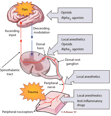 Redrawn with permission from Kehlet H, Dahl JB. The value of “multimodal” or “balanced analgesia” in postoperative pain treatment. AnesthAnalg 1993;77:1049.