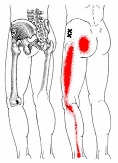 trigger point locations