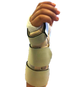 A volar wrist orthosis