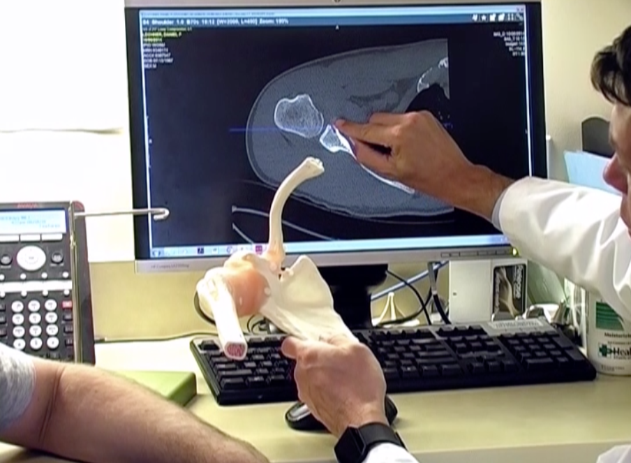 Shoulder Stabilization Washington Orthopaedics & Sports Medicine