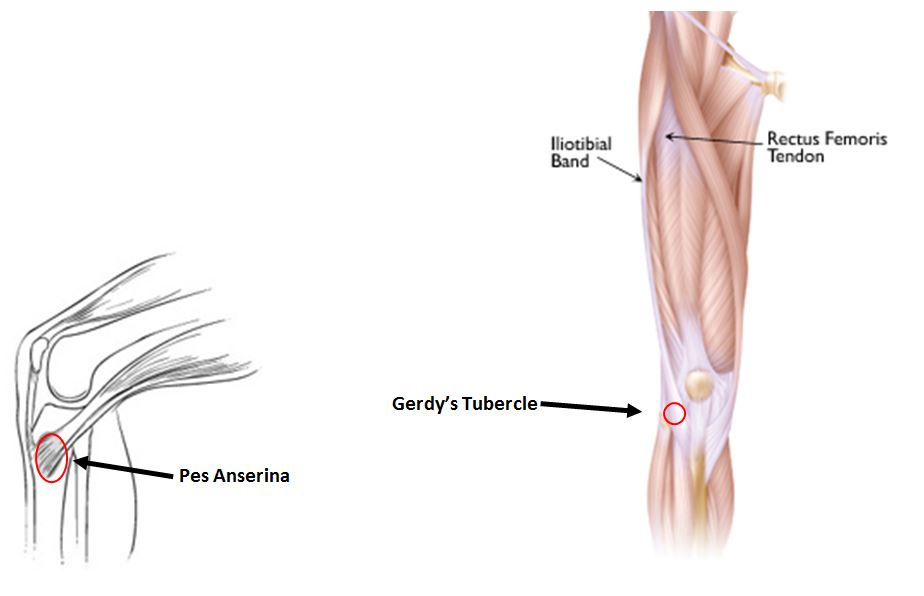 knee pain